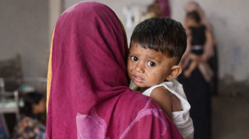 এক মাসে ১৬৯ শিশুর প্রাণ গেল হাম ও উপসর্গে