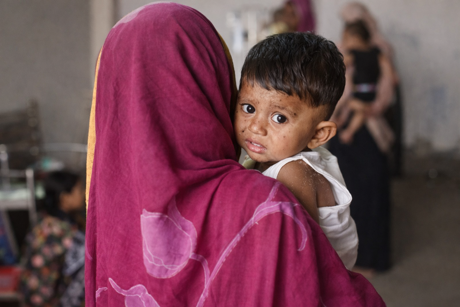 এক মাসে ১৬৯ শিশুর প্রাণ গেল হাম ও উপসর্গে